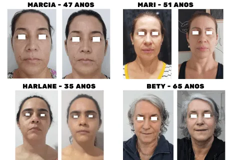 Antes e depois de aluna